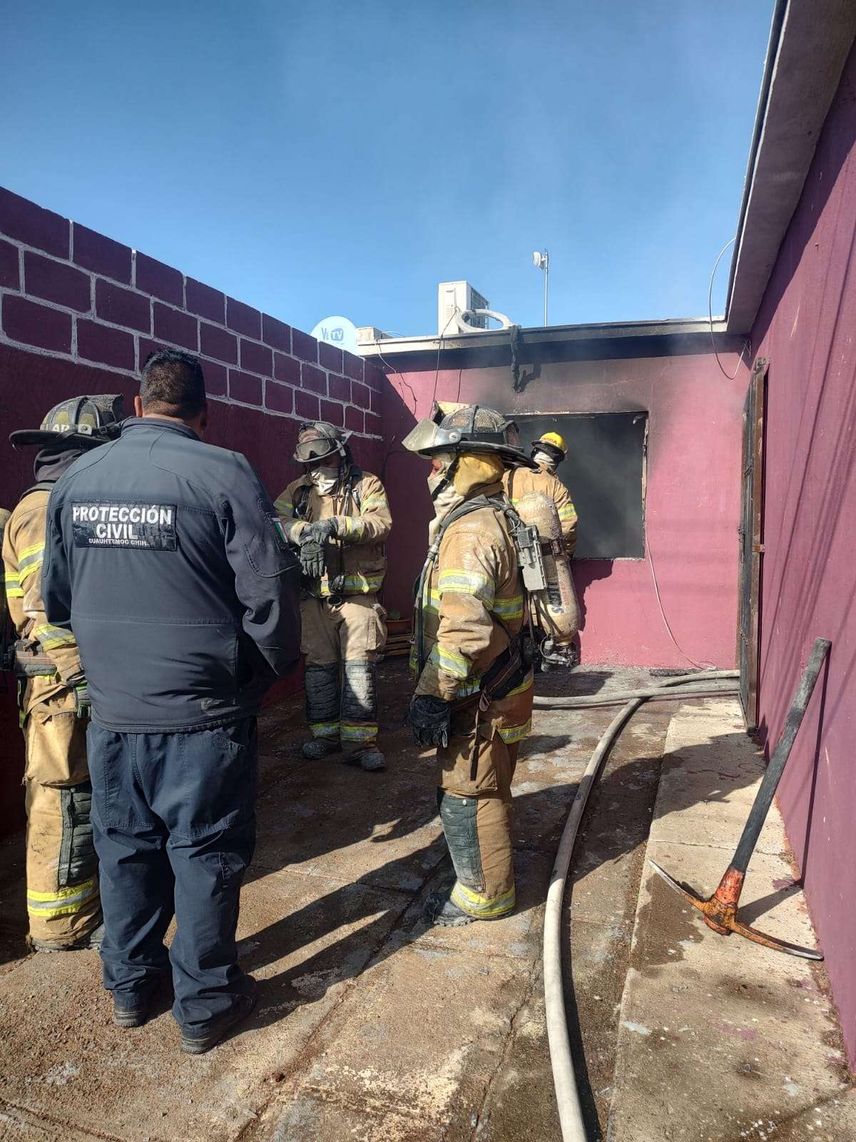 Sufre quemaduras de gravedad al incendiarse su casa | El Bordo